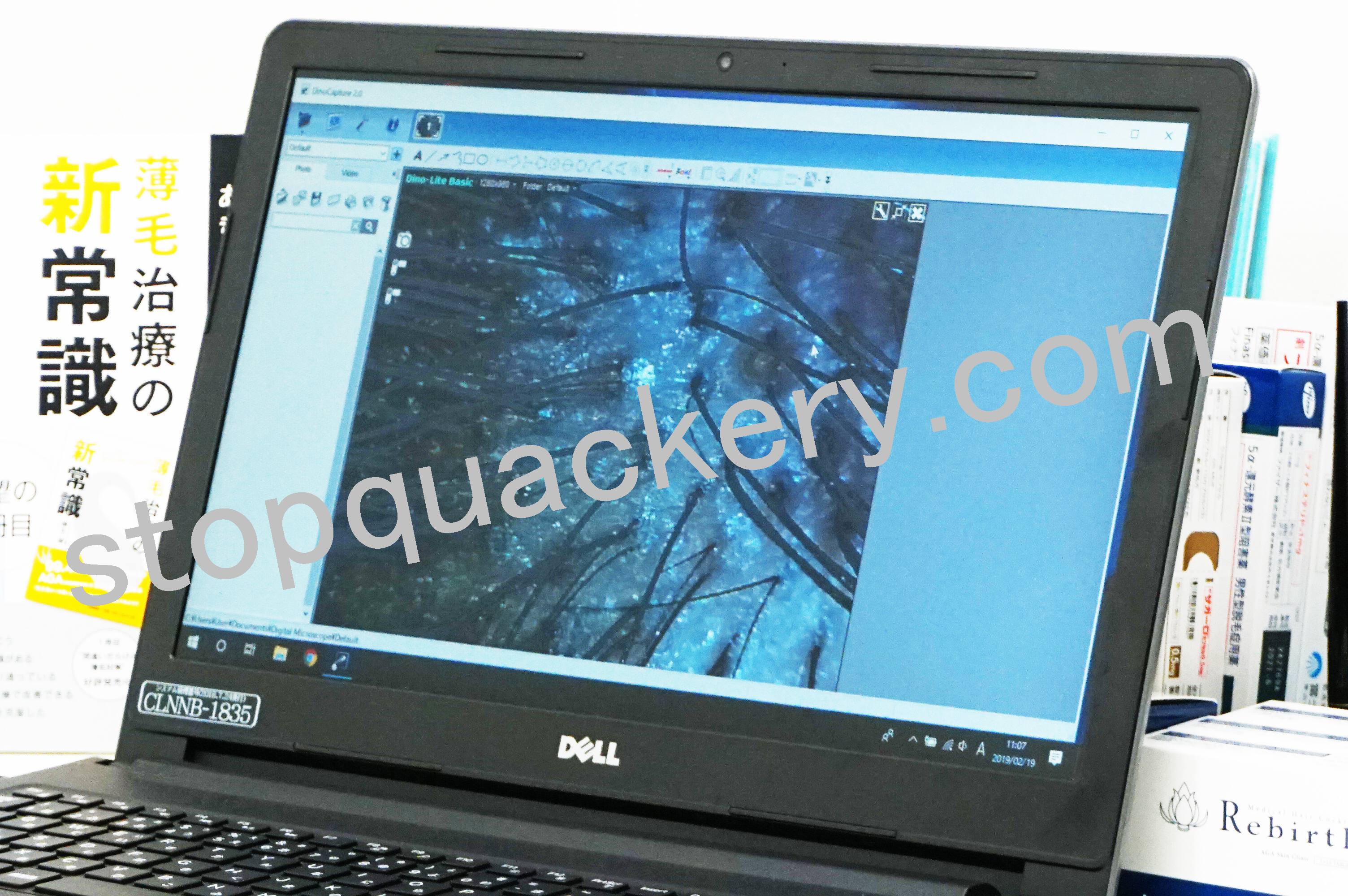 毛髪の状態を拡大します