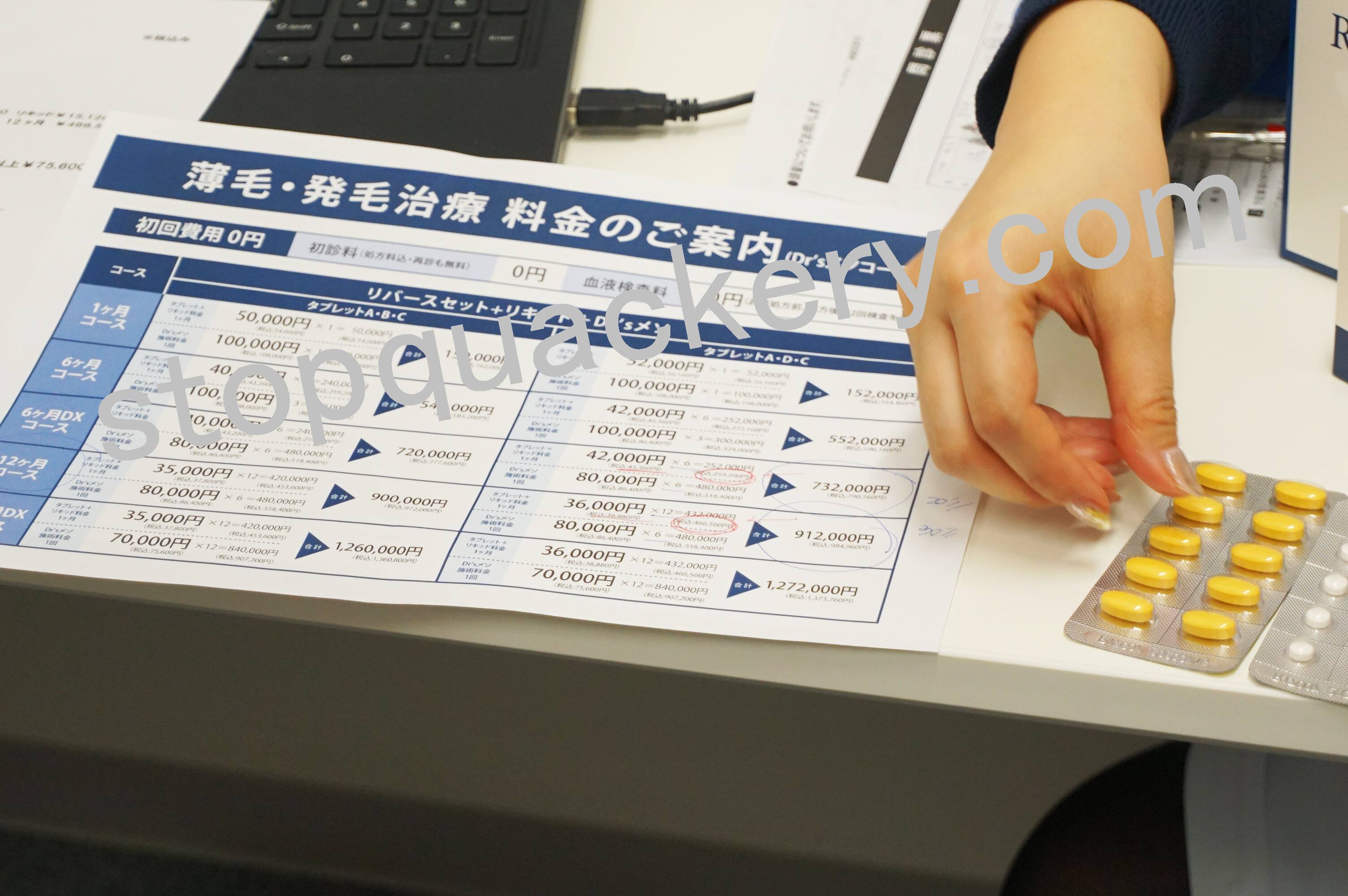 AGAスキンクリニックの内服薬の説明