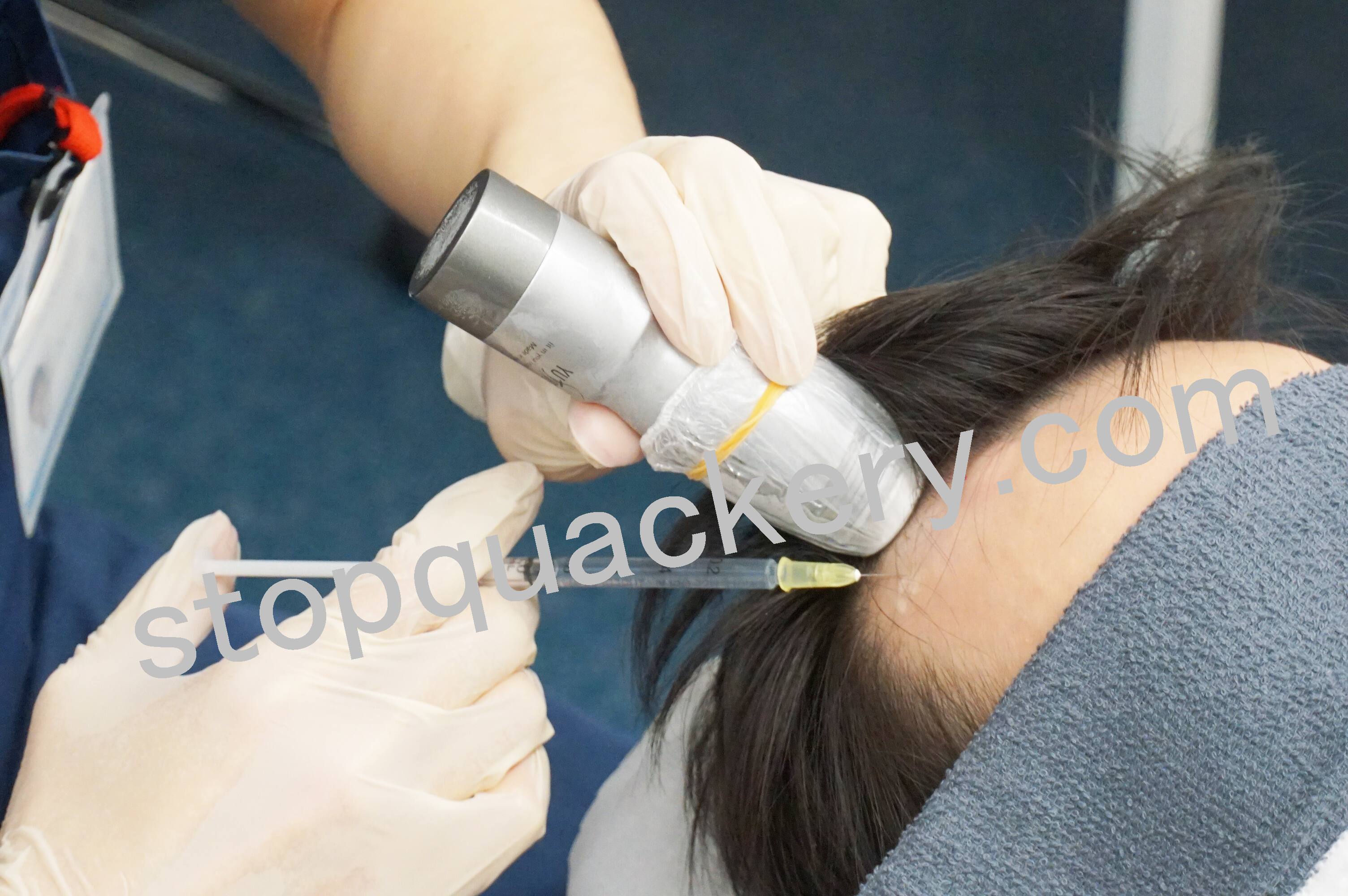 注射器の治療中