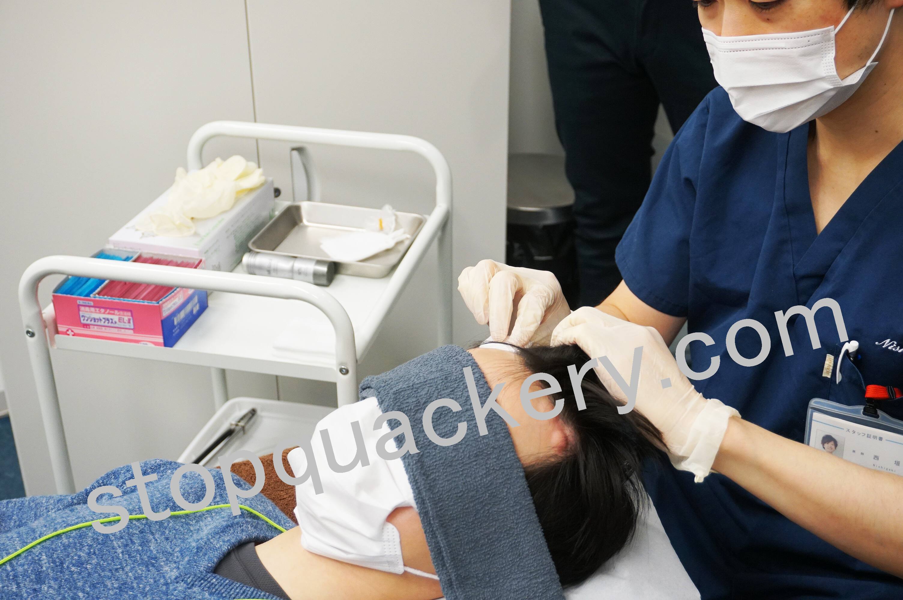 AGAスキンクリニックの治療